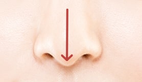 鼻中隔延長術