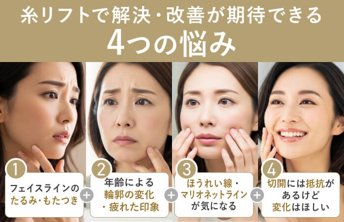 糸リフトで解決・改善が期待できる4つの悩み